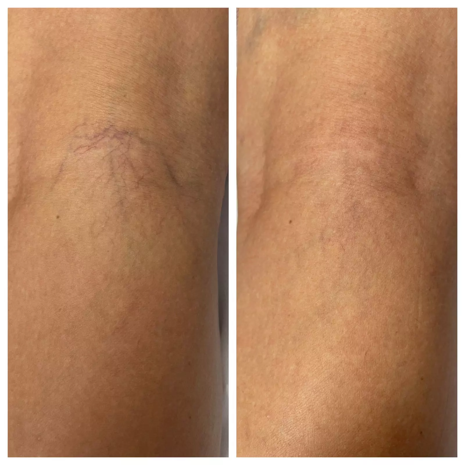 AnyConv.com__WhatsApp Image 2025-06-04 at 14.44.11