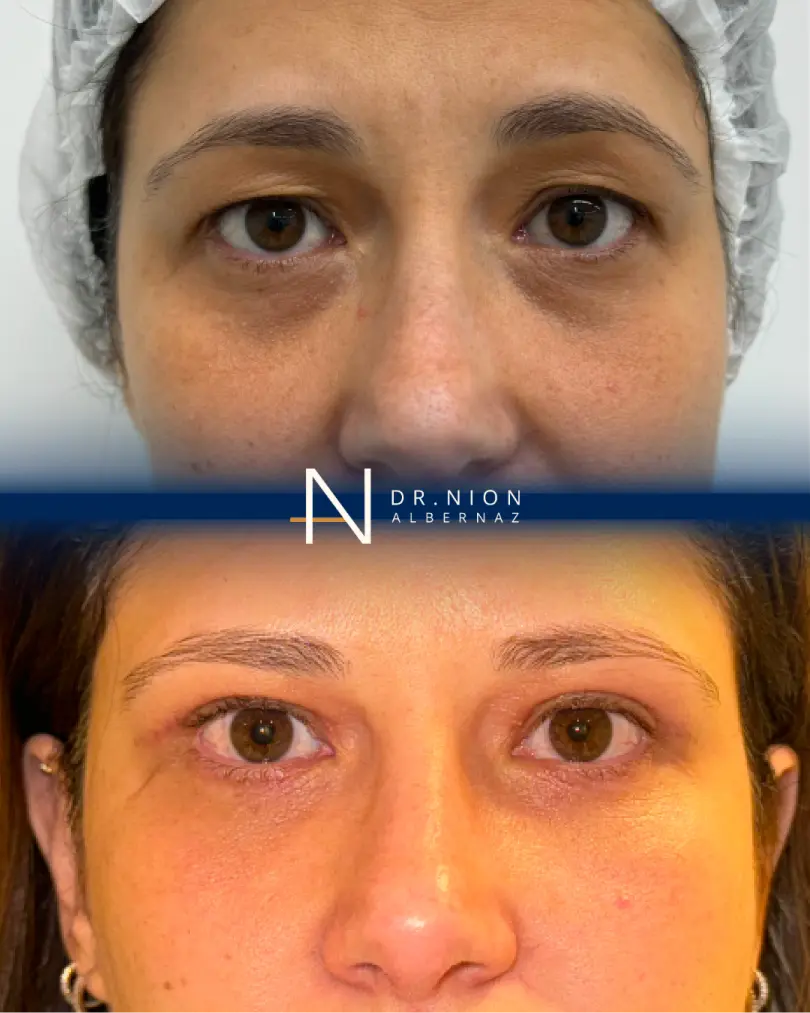 AnyConv.com__FOTO 5 (1)