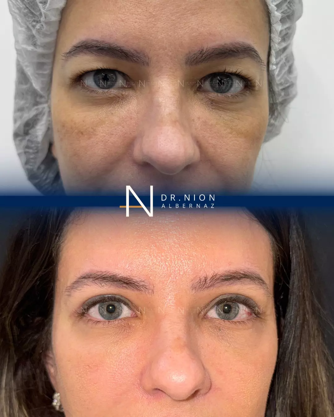 AnyConv.com__imgi_23_598456679_18023437091789072_3822639228359273454_n