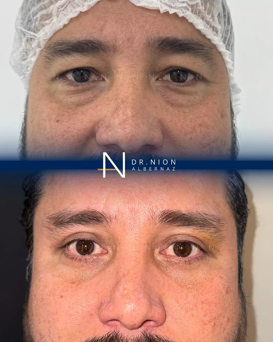 AnyConv.com__imgi_27_582125986_18020443196789072_539019924779334444_n