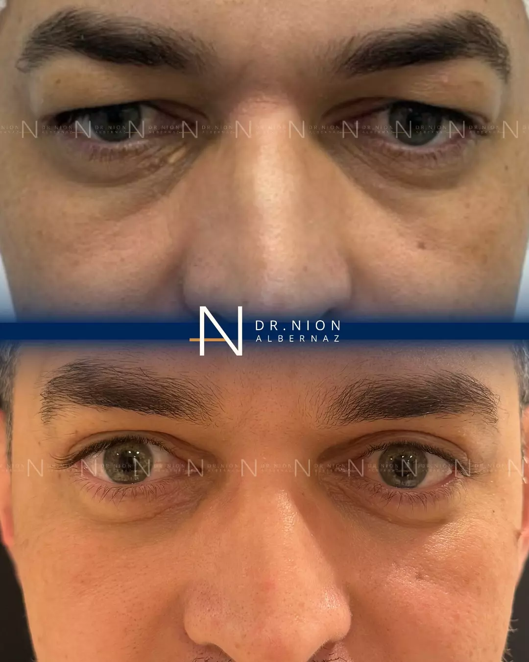 AnyConv.com__imgi_41_558831505_18015326270789072_3437207888335949740_n